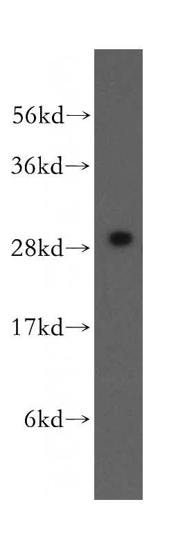 human brain tissue were subjected to SDS PAGE followed by western blot with Catalog No:111387(HDGFRP3 antibody) at dilution of 1:500