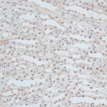 Immunohistochemistry - ZNF562 Polyclonal Antibody 