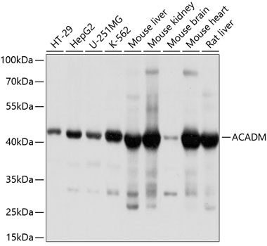 Western blot - ACADM Polyclonal Antibody 