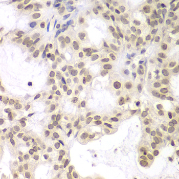 Immunohistochemistry - UHRF2 Polyclonal Antibody 