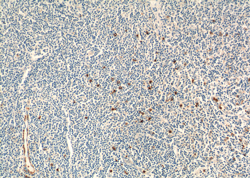 Immunohistochemistry of paraffin-embedded human tonsillitis tissue slide using Catalog No:112110(KLRF1 Antibody) at dilution of 1:50 (under 10x lens)
