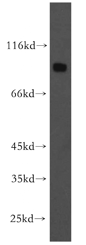 human brain tissue were subjected to SDS PAGE followed by western blot with Catalog No:110083(DNAI1 antibody) at dilution of 1:300