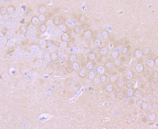 Fig3: Immunohistochemical analysis of paraffin-embedded mouse brain tissue using anti-MMP17 antibody. Counter stained with hematoxylin.