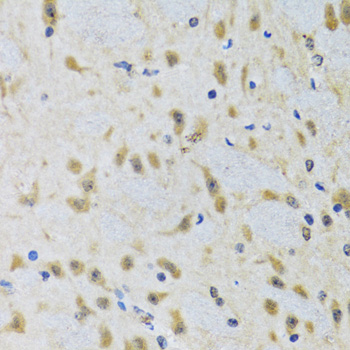 Immunohistochemistry - ATG7 Polyclonal Antibody. Immunohistochemistry of paraffin-embedded rat brain using ATG7 antibody at dilution of 1:100 (40x lens).