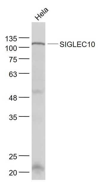 Fig1: Sample:; Hela(Human) Cell Lysate at 30 ug; Primary: Anti- SIGLEC10 at 1/1000 dilution; Secondary: IRDye800CW Goat Anti-Rabbit IgG at 1/20000 dilution; Predicted band size: 77 kD; Observed band size: 102 kD