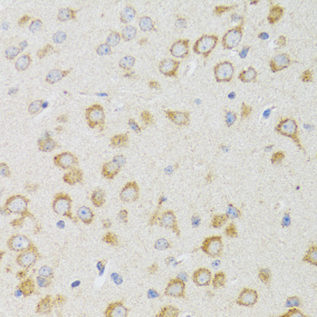 Immunohistochemistry - NEU1 Polyclonal Antibody 