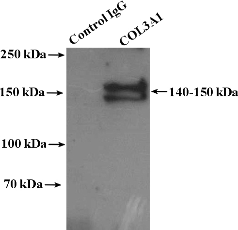 IP Result of anti-COL3A1 (IP:Catalog No:109377, 4ug; Detection:Catalog No:109377 1:500) with mouse skin tissue lysate 3200ug.
