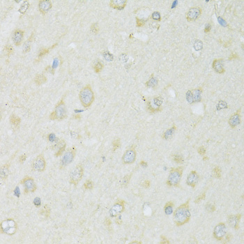 Immunohistochemistry - SLC22A5 Polyclonal Antibody 