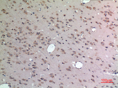 Fig2:; Immunohistochemical analysis of paraffin-embedded rat-brain, antibody was diluted at 1:100