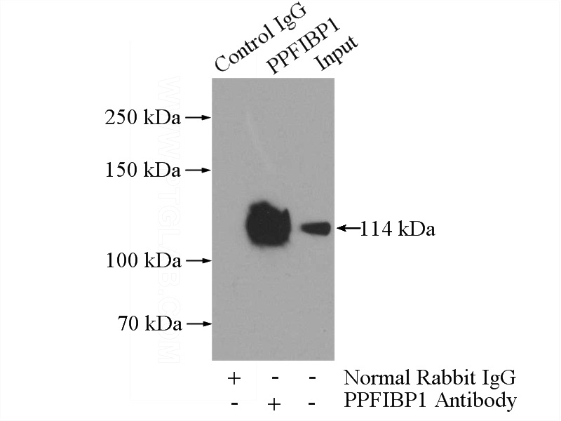 IP Result of anti-PPFIBP1 (IP:Catalog No:114121, 4ug; Detection:Catalog No:114121 1:500) with HepG2 cells lysate 2400ug.
