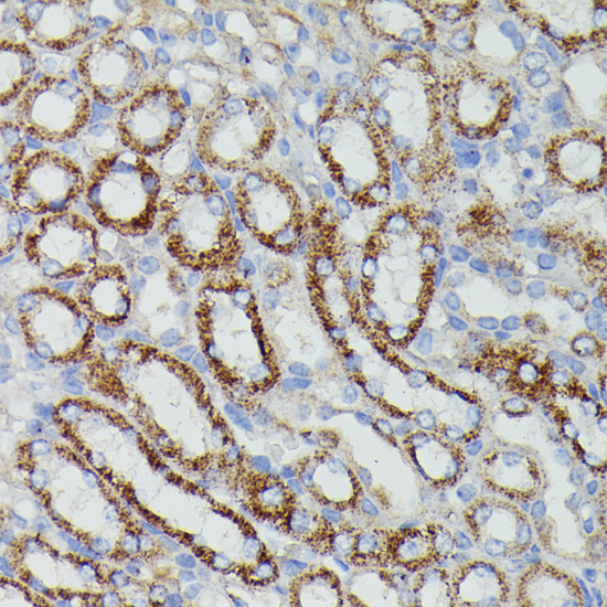 Immunohistochemistry - NDUFAB1 Polyclonal Antibody 