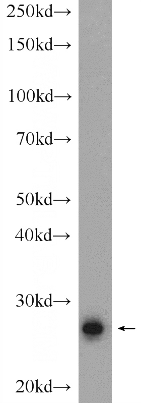 rat testis tissue were subjected to SDS PAGE followed by western blot with Catalog No:114743(RNF151 Antibody) at dilution of 1:600