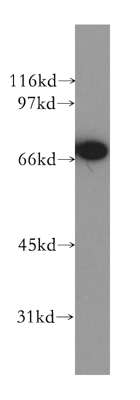 Jurkat cells were subjected to SDS PAGE followed by western blot with Catalog No:109726(CTNNBL1 antibody) at dilution of 1:500