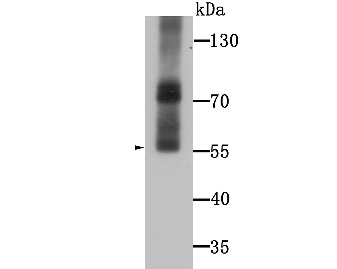 Fig2: Western blot analysis of WSCD2 on human stomach tissue lysate using anti-WSCD2 antibody at 1/1000 dilution.