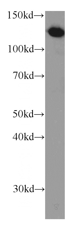 human brain tissue were subjected to SDS PAGE followed by western blot with Catalog No:107642(TRAPPC9,NIBP antibody) at dilution of 1:1000