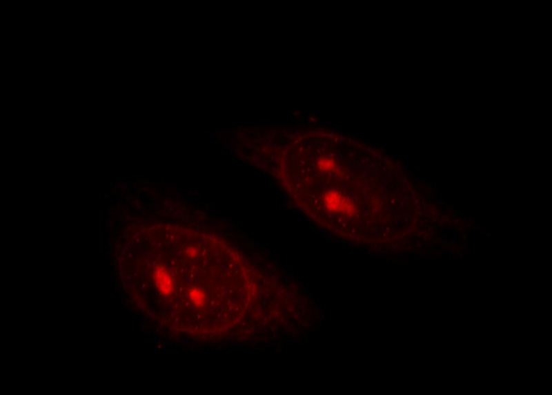 Immunofluorescent analysis of HepG2 cells, using TINF2 antibody Catalog No:116143 at 1:25 dilution and Rhodamine-labeled goat anti-rabbit IgG (red).