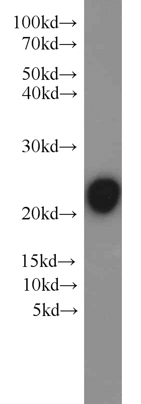 mouse brain tissue were subjected to SDS PAGE followed by western blot with Catalog No:112119(KRAS antibody) at dilution of 1:1000