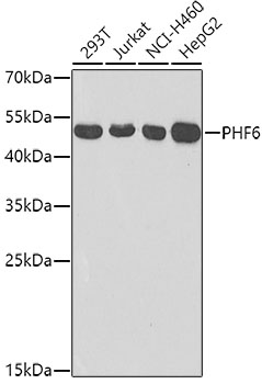 Western blot - PHF6 Polyclonal Antibody 