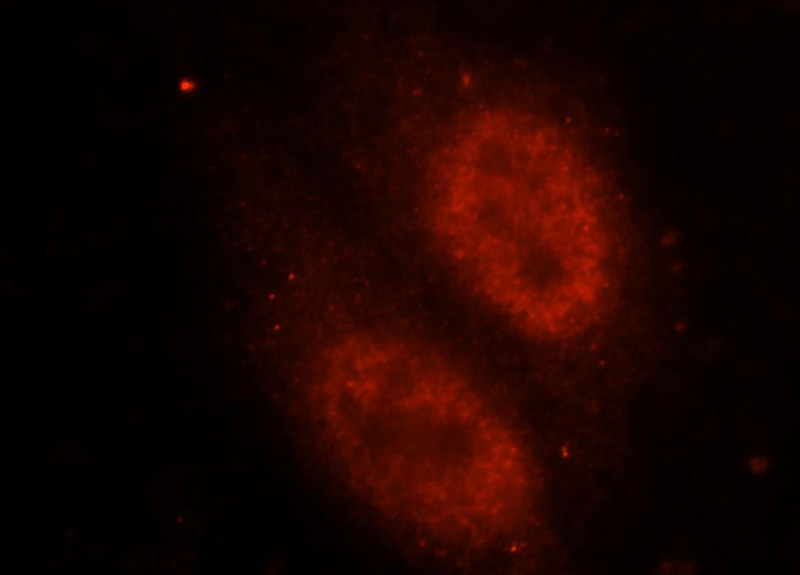 Immunofluorescent analysis of HepG2 cells, using FUS antibody Catalog No:110795 at 1:25 dilution and Rhodamine-labeled goat anti-rabbit IgG (red).
