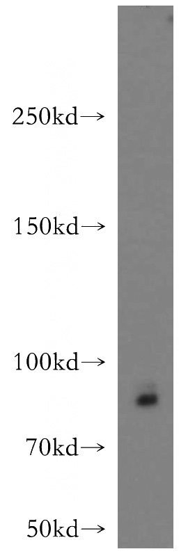 BxPC-3 cells were subjected to SDS PAGE followed by western blot with Catalog No:113715(POSTN antibody) at dilution of 1:500