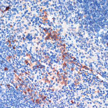 Immunohistochemistry - LRRK2 Polyclonal Antibody 