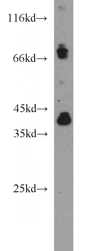 mouse liver tissue were subjected to SDS PAGE followed by western blot with Catalog No:114058(PON1 antibody) at dilution of 1:500