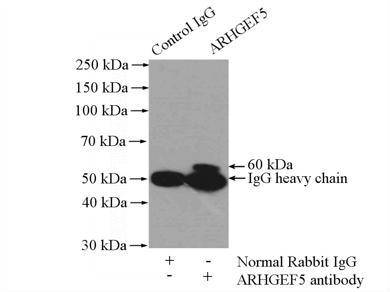 IP Result of anti-ARHGEF5 (IP:Catalog No:108188, 4ug; Detection:Catalog No:108188 1:500) with mouse kidney tissue lysate 4000ug.