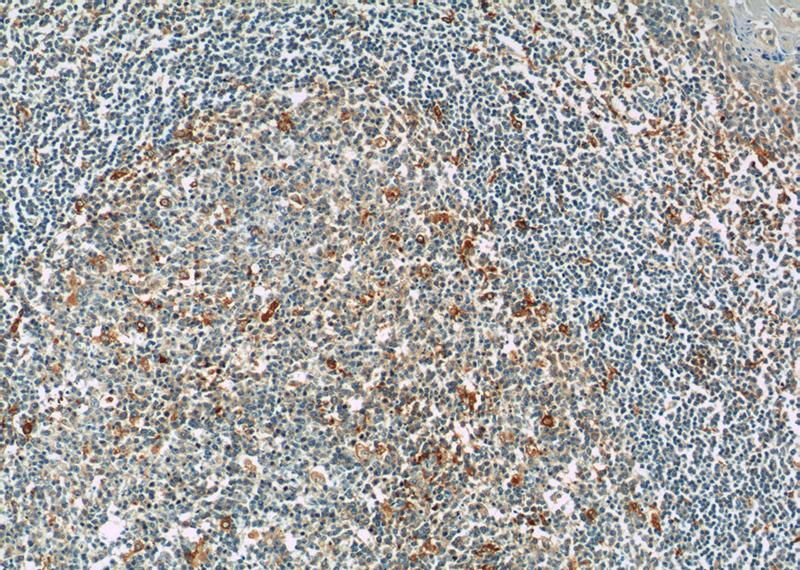 Immunohistochemistry of paraffin-embedded human tonsillitis tissue slide using Catalog No:110902(GCET2 Antibody) at dilution of 1:50 (under 10x lens)