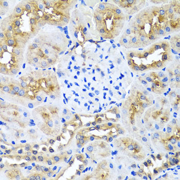 Immunohistochemistry - NIN Polyclonal Antibody 