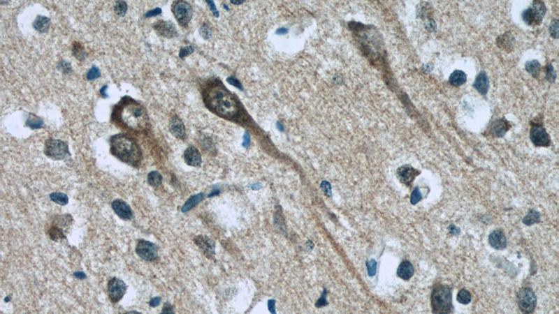 Immunohistochemistry of paraffin-embedded human brain tissue slide using Catalog No:107817(ABI2 Antibody) at dilution of 1:50 (under 40x lens)