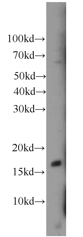 mouse heart tissue were subjected to SDS PAGE followed by western blot with Catalog No:108404(BAD antibody) at dilution of 1:300