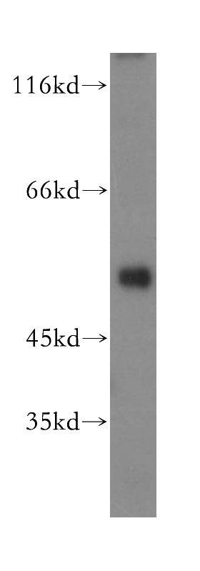 human heart tissue were subjected to SDS PAGE followed by western blot with Catalog No:112264(LACTB antibody) at dilution of 1:800