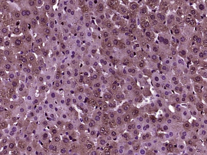 Fig3: Paraformaldehyde-fixed, paraffin embedded (mouse liver tissue); Antigen retrieval by boiling in sodium citrate buffer (pH6.0) for 15min; Block endogenous peroxidase by 3% hydrogen peroxide for 20 minutes; Blocking buffer (normal goat serum) at 37℃ for 30min; Antibody incubation with (Wnt11) Polyclonal Antibody, Unconjugated at 1:400 overnight at 4℃, followed by operating according to SP Kit(Rabbit) (sp-0023) instructionsand DAB staining.