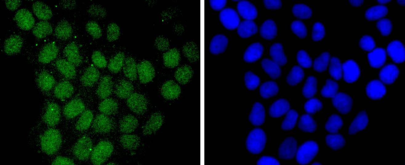 Fig3:; ICC staining Histone H2B(mono methyl R79) in MCF-7 cells (green). The nuclear counter stain is DAPI (blue). Cells were fixed in paraformaldehyde, permeabilised with 0.25% Triton X100/PBS.