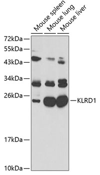 Western blot - KLRD1 Polyclonal Antibody 