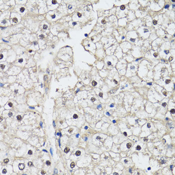 Immunohistochemistry - CDK7 Polyclonal Antibody 