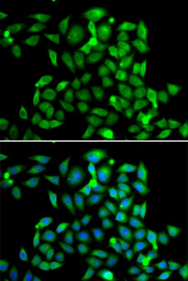 Immunofluorescence - CLASP1 Polyclonal Antibody 