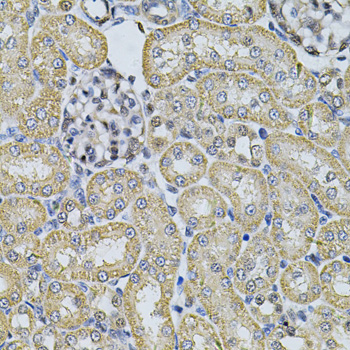 Immunohistochemistry - AP2A1 Polyclonal Antibody 
