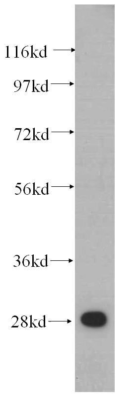 HeLa cells were subjected to SDS PAGE followed by western blot with Catalog No:114908(SCAR antibody) at dilution of 1:500