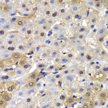Immunohistochemistry - MAD1L1 Polyclonal Antibody 