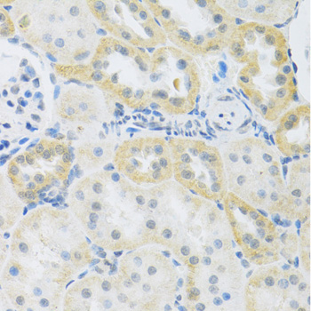 Immunohistochemistry - SLC39A7 Polyclonal Antibody 