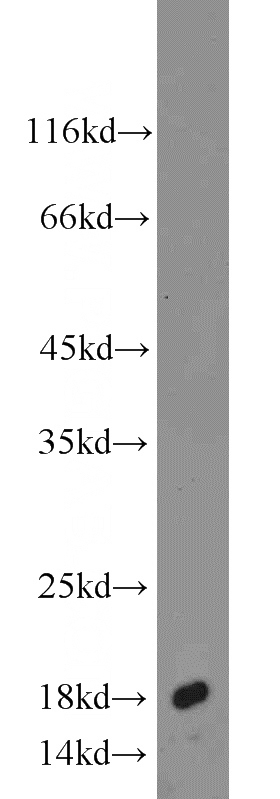 mouse stomach tissue were subjected to SDS PAGE followed by western blot with Catalog No:107835(AGR2 antibody) at dilution of 1:1000