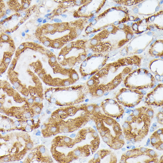 Immunohistochemistry - NUBP1 Polyclonal Antibody 