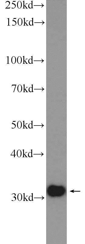 HeLa cells were subjected to SDS PAGE followed by western blot with Catalog No:115456(SNRPA Antibody) at dilution of 1:600