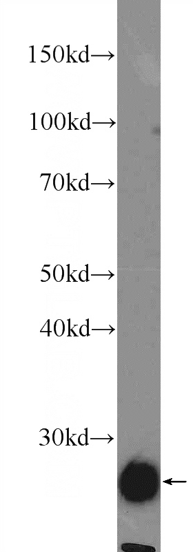 mouse cerebellum tissue were subjected to SDS PAGE followed by western blot with Catalog No:113165(NFU1 Antibody) at dilution of 1:1000