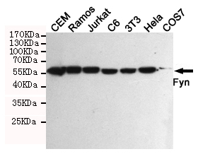 Western blot detection of Fyn in Hela,3T3,C6,COS7,CEM,Ramos and Jurkat cell lysates using Fyn mouse mAb (1:500 diluted).Predicted band size:59KDa.Observed band size:59KDa.