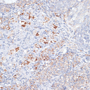Immunohistochemistry - SMPD1 / ASM Polyclonal Antibody 