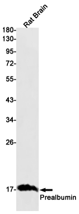 Western blot detection of Prealbumin in Rat Brain lysates using Prealbumin Rabbit mAb(1:1000 diluted).Predicted band size:16kDa.Observed band size:16kDa.