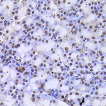 Immunohistochemistry - CSNK1E Polyclonal Antibody 
