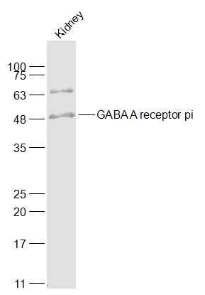 Fig1: Sample:; Kidney(Mouse) Lysate at 40 ug; Primary: Anti-GABA A receptor pi at 1/1000 dilution; Secondary: IRDye800CW Goat Anti-Rabbit IgG at 1/20000 dilution; Predicted band size: 49 kD; Observed band size: 49 kD